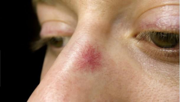 48岁男子肝癌晚期一旦身体出现3红2臭抓紧去查下肝功