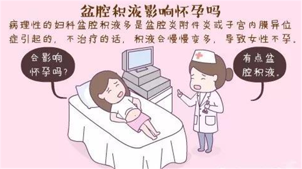广州供卵自怀（什么是盆腔积液?对俄罗斯试管婴儿胚胎移植有哪些影响）