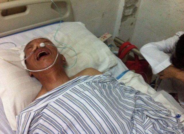 63岁老人深夜脑出血全身瘫痪一把年纪了还不知控制