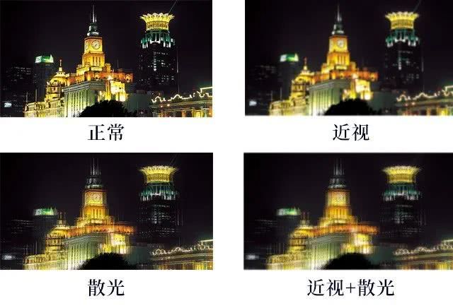 近视又散光是遗传吗还能治吗