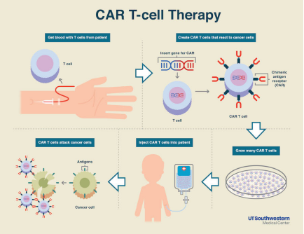 嵌合抗原受体t细胞免疫疗法(car-t)原理示意图