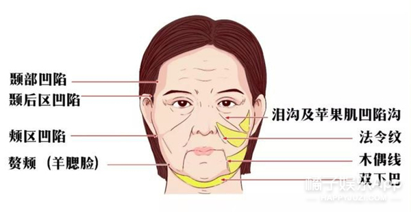 脸上横肉沟特别明显图片