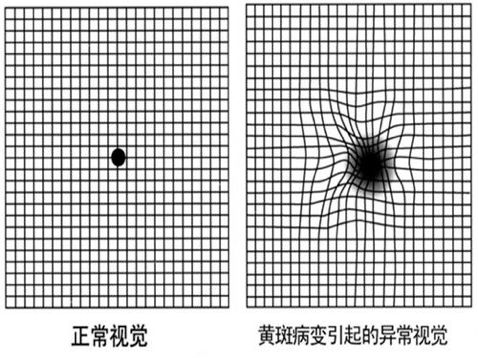 视物变形自测图片