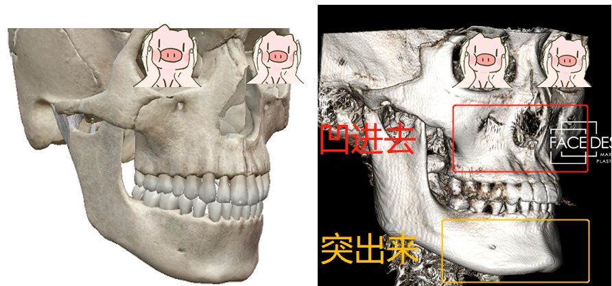 长腿妹因鞋拔子脸被认成男生花40万动骨大哥变成软甜萌妹