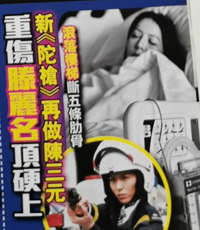 女星断五根肋骨卧床一个月，为拍TVB经典神剧带重伤复工