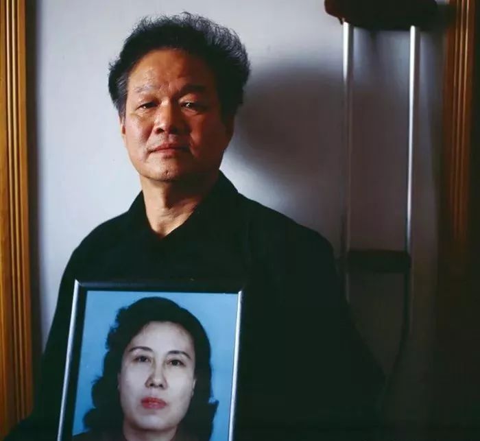 痛彻心扉过量使用激素的非典后遗症有多可怕