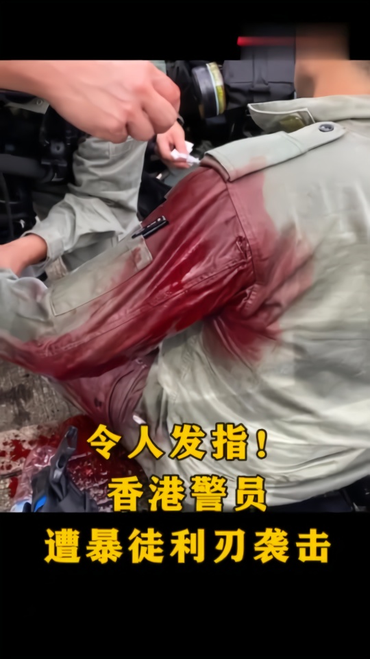 香港警员遭暴徒利刃袭击 警方：全力追凶绝不手软