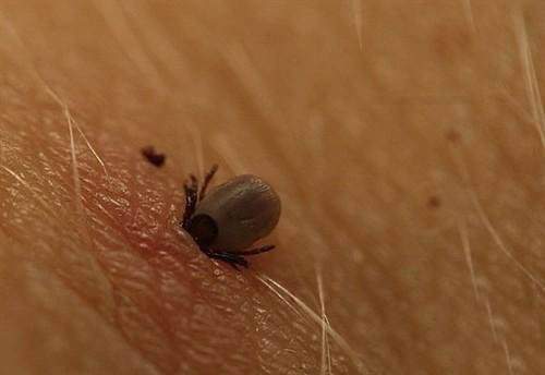 然而,当父母发现虱子后,最好在第一时间去医院,把它们交给医生治疗.