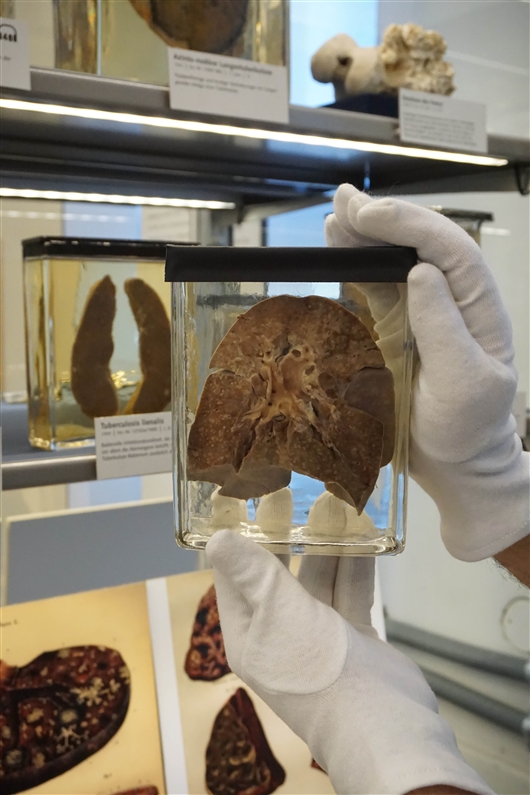 德国柏林医学历史博物馆的标本 图片来源:navena widulin