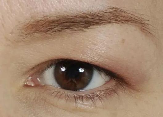 双眼皮不好看 如何拥有真正迷人大眼?