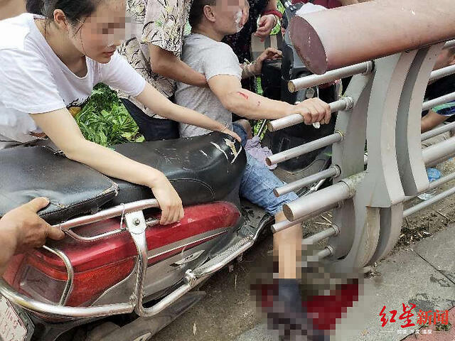 隔着屏幕都感觉痛男子骑车摔倒被路边金属护栏刺穿小腿