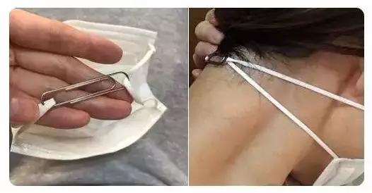 壹知肤天天戴口罩耳朵疼长痘痘解决方法来了