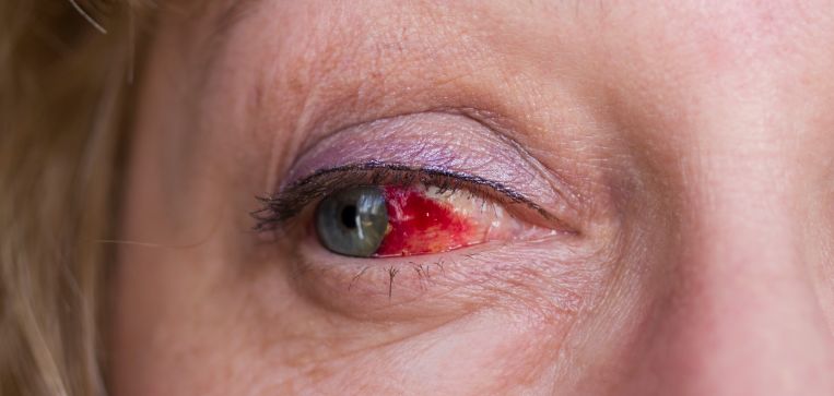 骇人!23岁女子泡红枣养生茶,结果眼球不慎被炸裂