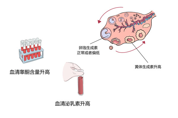 服用達英的目的是降低雄激素水平,確實可以把睪酮素降下來,但這只是