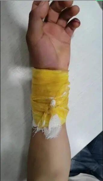 生死70分钟红河一男子在快手直播自杀跳桥轻生未遂又割腕结果