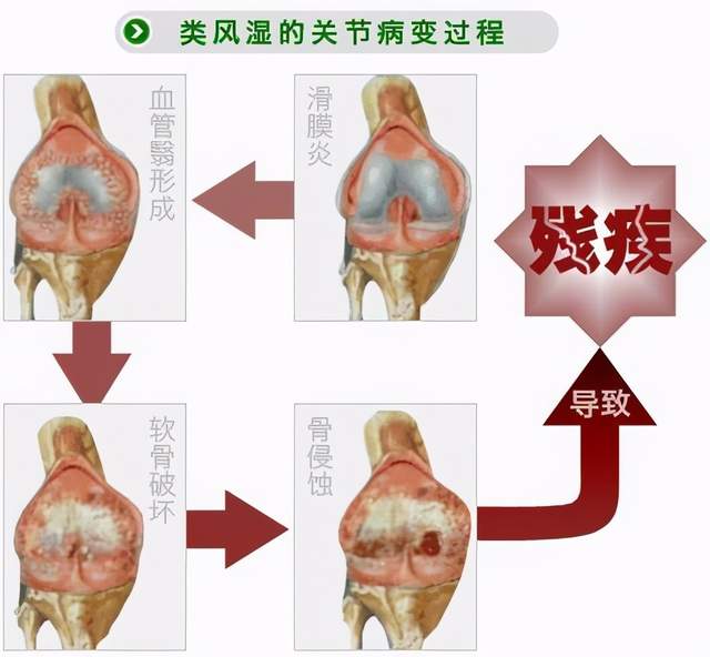 風路同行感恩有您感恩節┃貴陽中醫風溼病醫院進社區義診