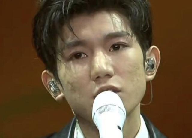 王源长痘郭京飞卡粉明星那么有钱为什么皮肤还是不好