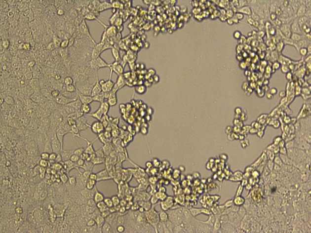 早期出现病变的vero-e6传代细胞