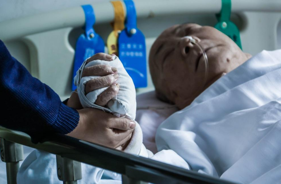 帕金森病人临终好痛苦是吗