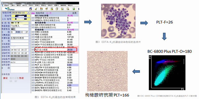 血小板聚集,一文教你破解大法