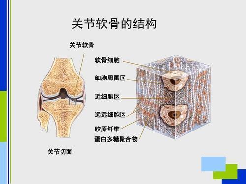 膝关节退行性骨关节炎怎么办