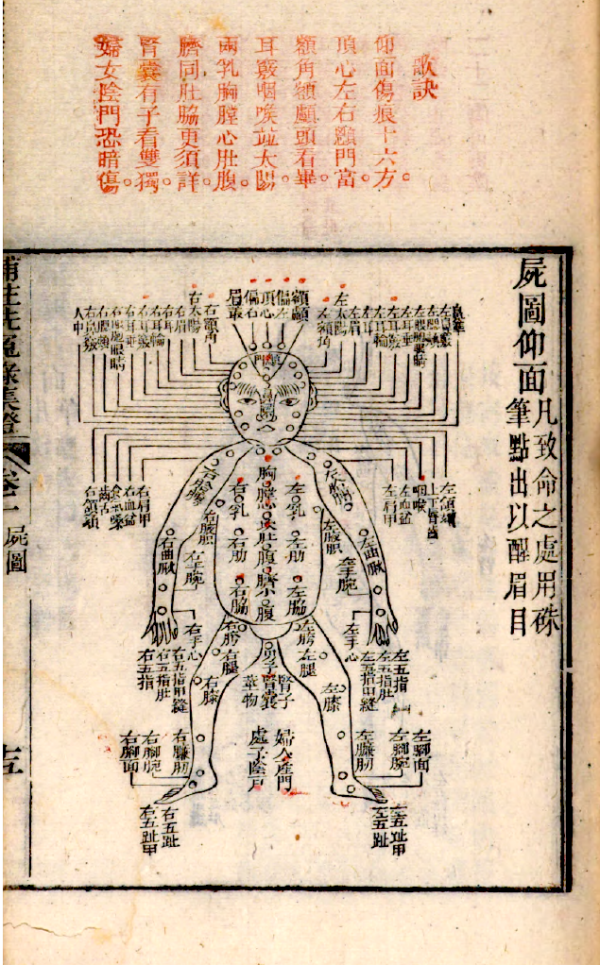 《重刊补注洗冤录集证》,1843年三色套印版(本文图片均由多伦多大学陈利教授提供)。