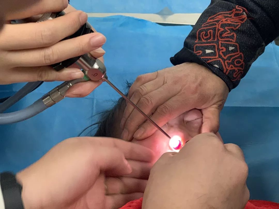 儿童鼻腔塞进异物,家长吓傻,仁品秒秒钟取出__凤凰网