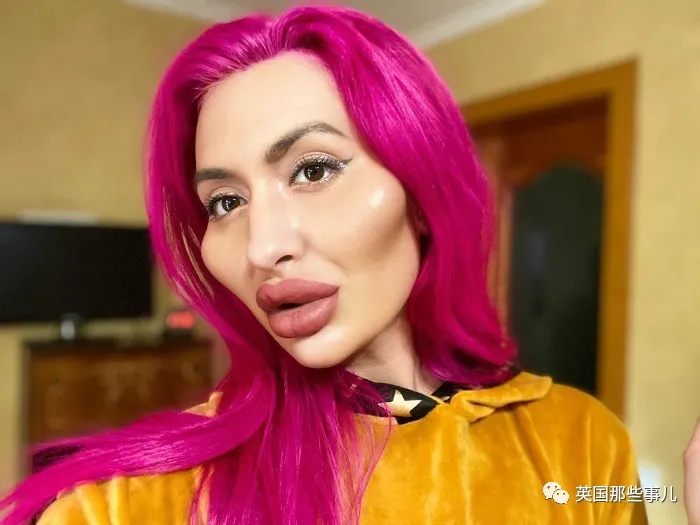 网红沉迷整容,自己在家给脸上打针,结果现在整成这样?好可怕