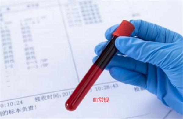 成都供卵生殖中心（解析科学备孕前的常见检查项目）