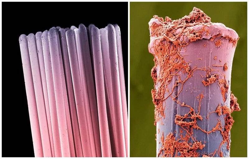 别让你的牙刷毒害你了tflash电动牙刷自带消毒健康无忧