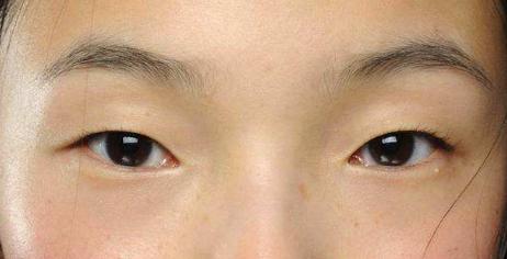 戴上口罩:单眼皮小眼睛要哭辽,如何拯救被眼睛出卖的颜值?