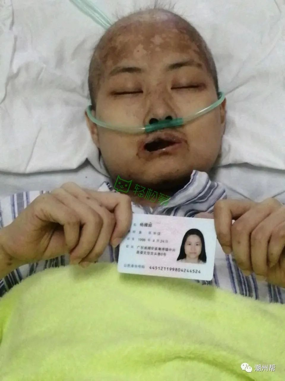 潮州23岁女子身患急性淋巴白血病,请帮帮我,给我一个为父母尽孝的机会