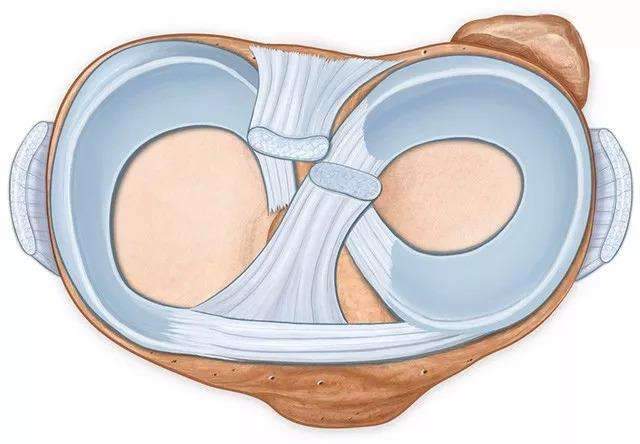 半月板是什麼為什麼半月板會損傷
