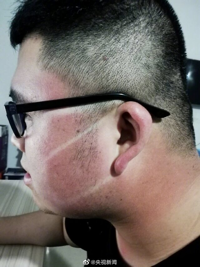 交警被晒成口罩脸__凤凰网