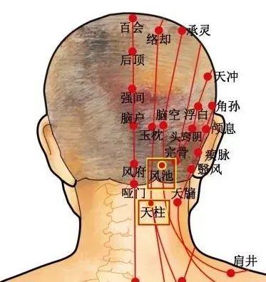 头痛又犯了,如何自己搞定偏头疼?