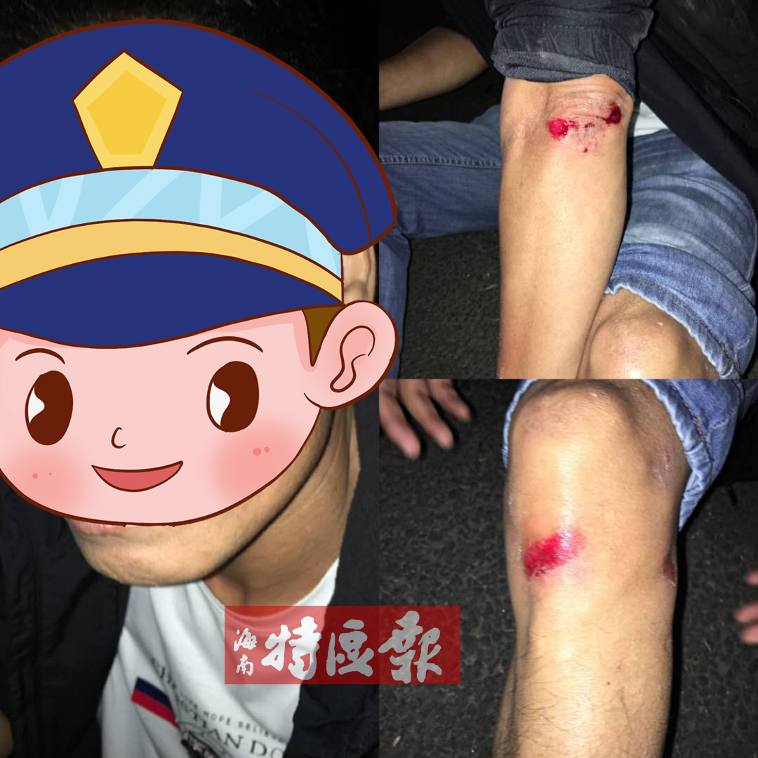 便衣队员全身多处受伤