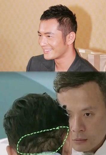 明星也爱植发,你可能不知道这三个明星