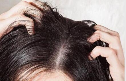 头发为何越洗越油 油性发质有解决办法吗 凤凰网