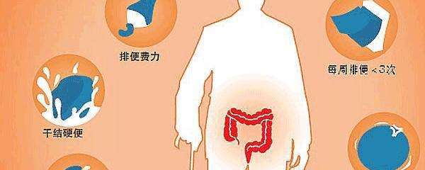 武汉国医堂哪些便秘患者需要做肠镜检查