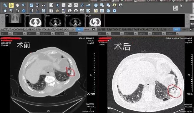 擅长：肿瘤介入治疗：肝癌的超分割放射治疗、经皮穿刺微波凝固治疗、射频治疗；食管癌外照射与近...黄牛票贩子号贩子一个电话的简单介绍