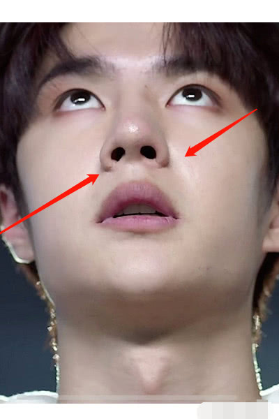 欧阳娜娜最新大片鼻翼惊现不明疤痕被质疑整容做了鼻翼缩小手术