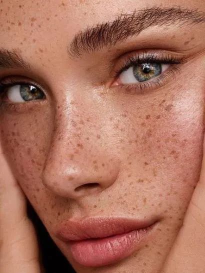 戴口罩闷出痘痘脸开启紧急防护戳这里