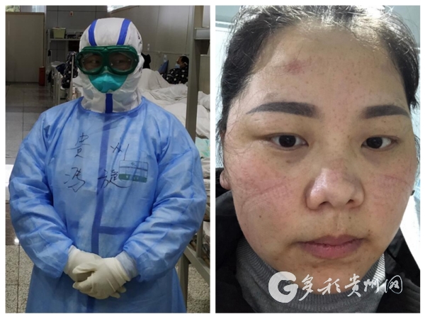 2月4日,冯旋与全省100名医疗队成员一起,奔赴湖北