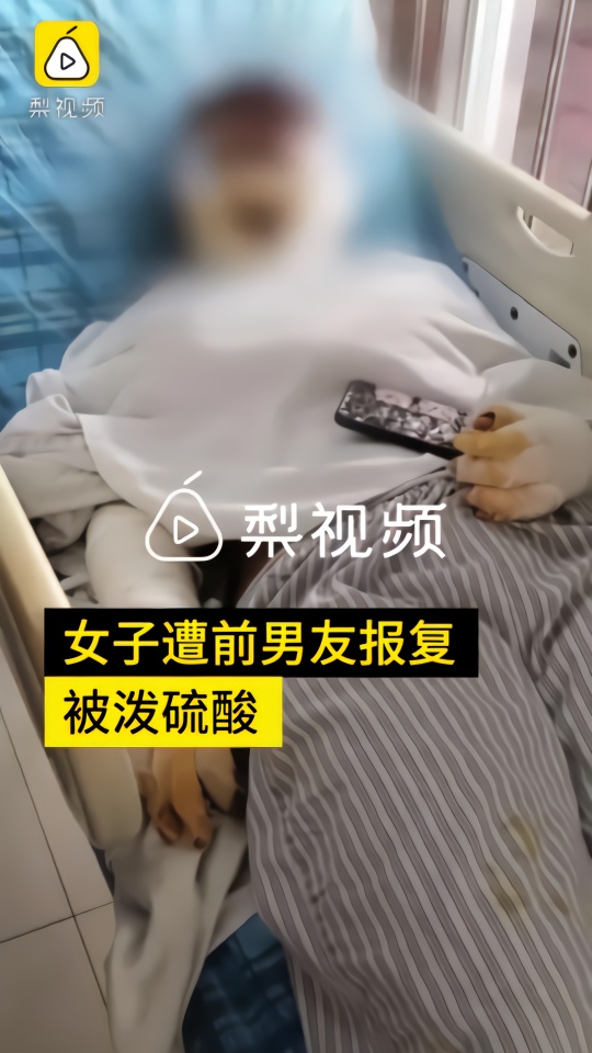 女子被前男友泼硫酸还遭恐吓:得不到你就毁掉你