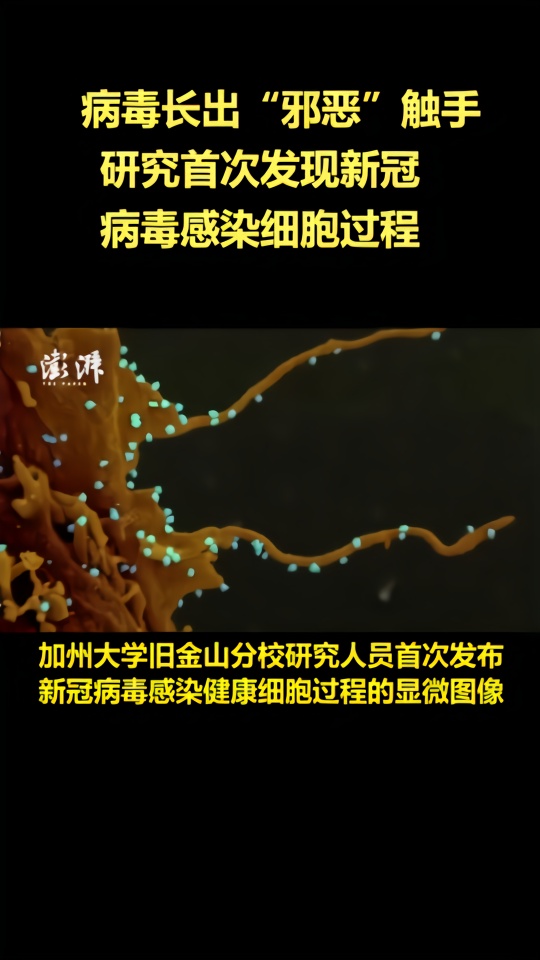 病毒长出“邪恶”触手，研究首次发现新冠病毒感染细胞过程