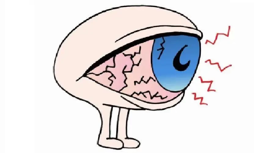 得了急性结膜炎应该注意什么