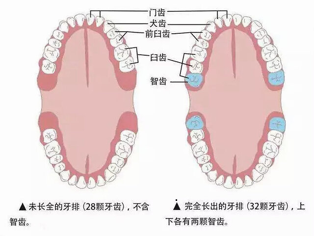 如果智齿长歪了 你将会面临这两个大麻烦 凤凰网