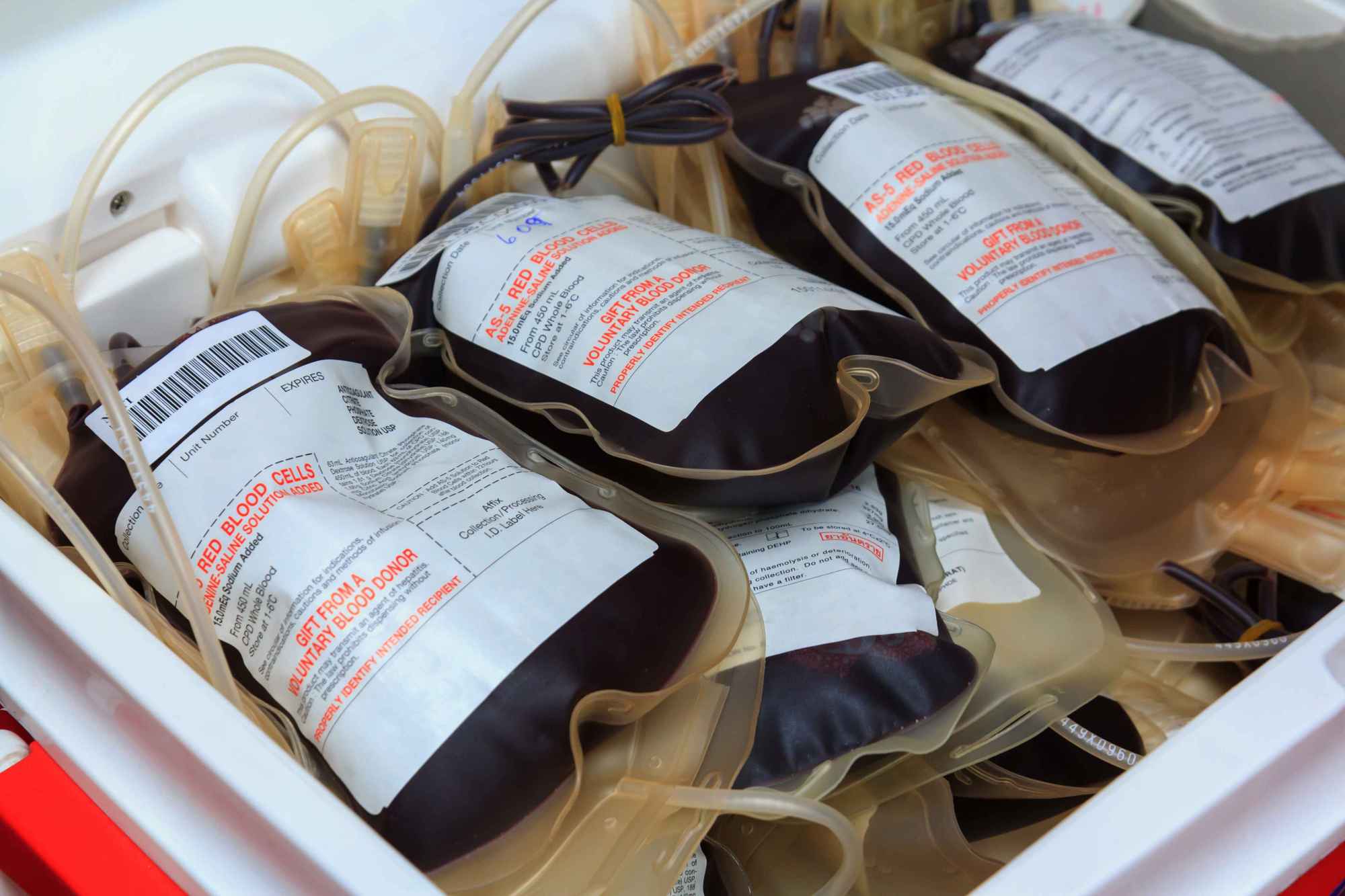 每年献血400毫升可能会轻松得到几个好处很多人还不清楚