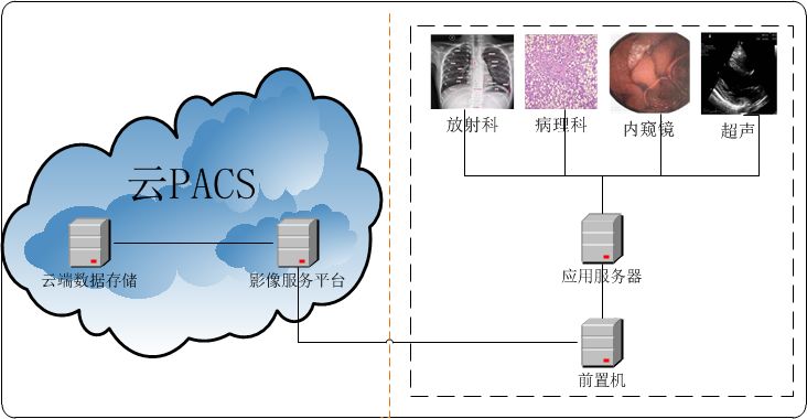 云pacs系统在远程影像诊断中的应用
