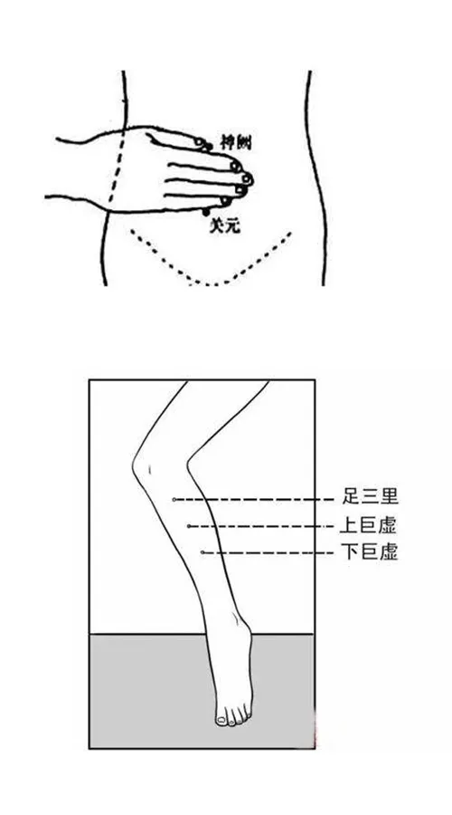 艾灸解决五大便秘类型